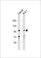 Colony Stimulating Factor 3 Receptor antibody, 63-768, ProSci, Western Blot image 