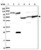 RNA Polymerase II Associated Protein 2 antibody, PA5-61244, Invitrogen Antibodies, Western Blot image 