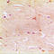 Actin Gamma 2, Smooth Muscle antibody, LS-C351784, Lifespan Biosciences, Immunohistochemistry paraffin image 