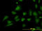 Stromal Interaction Molecule 1 antibody, LS-B4424, Lifespan Biosciences, Immunofluorescence image 
