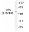 p65 antibody, AP01652PU-N, Origene, Western Blot image 