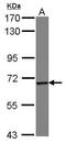Epsin 1 antibody, GTX115900, GeneTex, Western Blot image 