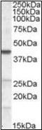 CGI58 antibody, orb89724, Biorbyt, Western Blot image 