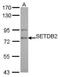 SET Domain Bifurcated Histone Lysine Methyltransferase 2 antibody, NBP1-31264, Novus Biologicals, Western Blot image 