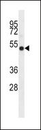 Indoleamine 2,3-Dioxygenase 2 antibody, LS-C165098, Lifespan Biosciences, Western Blot image 