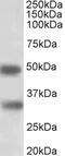 Replication Timing Regulatory Factor 1 antibody, 43-054, ProSci, Western Blot image 