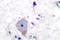 Platelet Derived Growth Factor Receptor Alpha antibody, LS-C176549, Lifespan Biosciences, Immunohistochemistry frozen image 