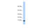 Pterin-4 Alpha-Carbinolamine Dehydratase 1 antibody, 25-402, ProSci, Western Blot image 