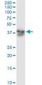 Alcohol Dehydrogenase 5 (Class III), Chi Polypeptide antibody, H00000128-M01, Novus Biologicals, Western Blot image 