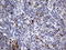 DNA Topoisomerase II Alpha antibody, LS-C789548, Lifespan Biosciences, Immunohistochemistry paraffin image 