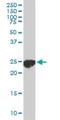 Caseinolytic Mitochondrial Matrix Peptidase Proteolytic Subunit antibody, H00008192-M01, Novus Biologicals, Western Blot image 