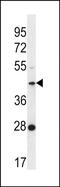 OTU Deubiquitinase With Linear Linkage Specificity Like antibody, PA5-48412, Invitrogen Antibodies, Western Blot image 