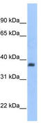 ST3 Beta-Galactoside Alpha-2,3-Sialyltransferase 2 antibody, TA341870, Origene, Western Blot image 