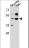 Prolyl 3-Hydroxylase Family Member 4 (Non-Enzymatic) antibody, LS-C162882, Lifespan Biosciences, Western Blot image 