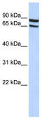 Solute Carrier Family 6 Member 15 antibody, TA333381, Origene, Western Blot image 