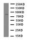 ADAM Metallopeptidase Domain 2 antibody, LS-C313499, Lifespan Biosciences, Western Blot image 