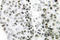 Snail Family Transcriptional Repressor 1 antibody, LS-C176686, Lifespan Biosciences, Immunohistochemistry paraffin image 