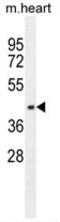 Adaptor Related Protein Complex 1 Subunit Mu 1 antibody, AP50198PU-N, Origene, Western Blot image 