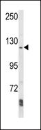 AP2 Associated Kinase 1 antibody, LS-C155831, Lifespan Biosciences, Western Blot image 