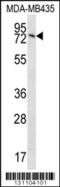 Sad1 And UNC84 Domain Containing 2 antibody, 56-427, ProSci, Western Blot image 