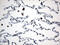 TFIIIC90 antibody, M12724, Boster Biological Technology, Immunohistochemistry paraffin image 