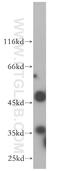 Citrate Lyase Beta Like antibody, 17314-1-AP, Proteintech Group, Western Blot image 