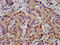 Calcium Voltage-Gated Channel Auxiliary Subunit Beta 2 antibody, LS-C670030, Lifespan Biosciences, Immunohistochemistry paraffin image 