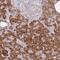 Zinc Finger Protein 510 antibody, PA5-61893, Invitrogen Antibodies, Immunohistochemistry paraffin image 