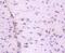 Integrin Linked Kinase antibody, NBP2-67621, Novus Biologicals, Immunohistochemistry paraffin image 