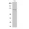 Interleukin 1 Receptor Associated Kinase 1 antibody, LS-C384180, Lifespan Biosciences, Western Blot image 