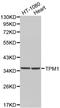 Tropomyosin 1 antibody, LS-C192410, Lifespan Biosciences, Western Blot image 