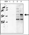 Activin A Receptor Like Type 1 antibody, PA5-14921, Invitrogen Antibodies, Western Blot image 