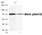 Neurofibromin 2 antibody, P00279-1, Boster Biological Technology, Western Blot image 