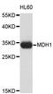 Malate Dehydrogenase 1 antibody, STJ24531, St John