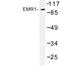 F4/80 antibody, LS-C177497, Lifespan Biosciences, Western Blot image 