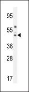 Serpin Family A Member 6 antibody, PA5-24229, Invitrogen Antibodies, Western Blot image 