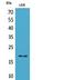 Eukaryotic Translation Initiation Factor 5A2 antibody, A05688, Boster Biological Technology, Western Blot image 