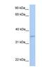 NFKB Inhibitor Interacting Ras Like 2 antibody, NBP1-58925, Novus Biologicals, Western Blot image 