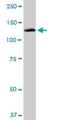 Presequence protease, mitochondrial antibody, H00010531-M03, Novus Biologicals, Western Blot image 