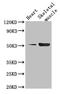 Tryptophan Hydroxylase 1 antibody, orb47527, Biorbyt, Western Blot image 
