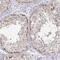 Transketolase Like 1 antibody, PA5-51394, Invitrogen Antibodies, Immunohistochemistry frozen image 