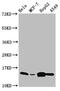 Interferon Induced Transmembrane Protein 2 antibody, CSB-PA011025LA01HU, Cusabio, Western Blot image 
