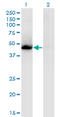 Nuclear Receptor Subfamily 1 Group H Member 3 antibody, LS-C139252, Lifespan Biosciences, Western Blot image 