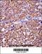 Eukaryotic Translation Initiation Factor 5A2 antibody, 57-447, ProSci, Immunohistochemistry paraffin image 