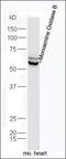 Microtubule Associated Protein 1 Light Chain 3 Alpha antibody, orb157781, Biorbyt, Western Blot image 