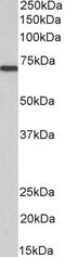 Myotubularin 1 antibody, PA5-17972, Invitrogen Antibodies, Western Blot image 