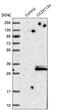 Coiled-Coil Domain Containing 134 antibody, PA5-52029, Invitrogen Antibodies, Western Blot image 