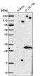 Coiled-Coil Domain Containing 134 antibody, PA5-52029, Invitrogen Antibodies, Western Blot image 