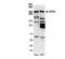 NIPBL Cohesin Loading Factor antibody, NB100-93320, Novus Biologicals, Western Blot image 