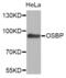 Oxysterol-binding protein 1 antibody, PA5-76474, Invitrogen Antibodies, Western Blot image 